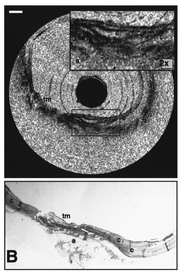 Technologie laser (3)