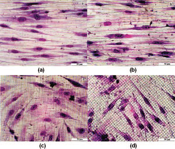 Applications du laser (5)